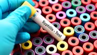 Broj obolelih od sifilisa u Srbiji najveći u poslednjih 10 godina: Rastu polno prenosive bolesti