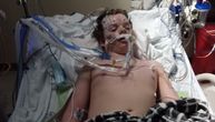 Dečak progutao 14 tableta zbog opasnog izazova na TikToku: Umro je posle 6 dana na aparatima