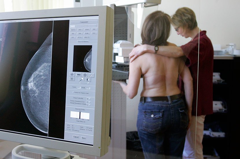 Mamogram, rak dojke