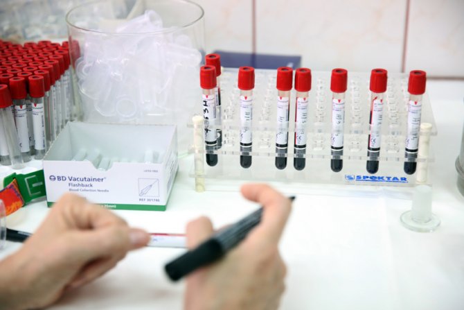 Testiranje na HIV, Gradski zavod za javno zdravlje Beograd