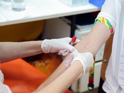 Testiranje na HIV, Gradski zavod za javno zdravlje Beograd