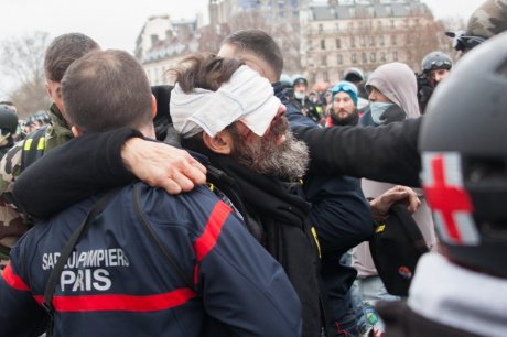 Jerome Rodrigues, Yellow Vests, zuti prsluci, Demonstracije, protesti u Parizu, Francuska, France Protests
