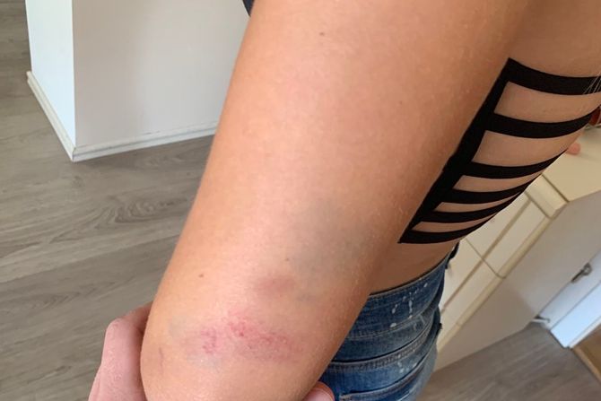 Povreda, manijak Povreda, manijak