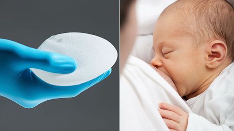 Beba koja sisa, silikon za grudi