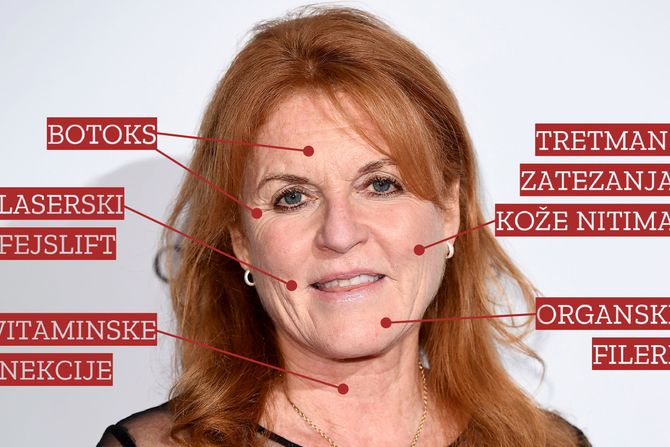 Sarah Ferguson