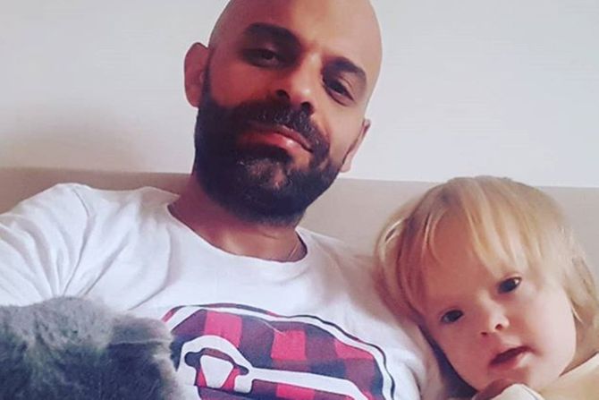 Devojcica sa daunovim sindromom Devojcica sa daunovim sindromom