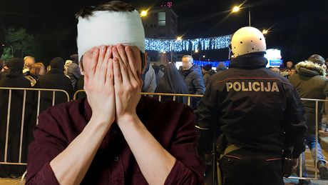 Protesti u Crnoj Gori, razbijena glava