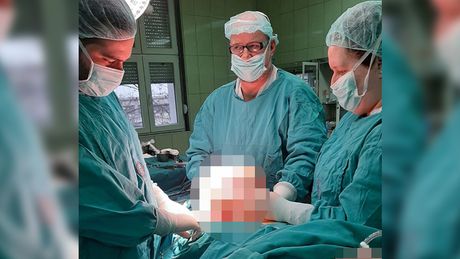 Tumor od pola metra, beogradski lekari, operacija