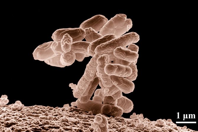 Escherichia E coli,  Ešerihija koli bakterija bakterije