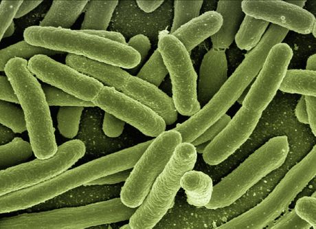 Escherichia E coli,  Ešerihija koli bakterija bakterije