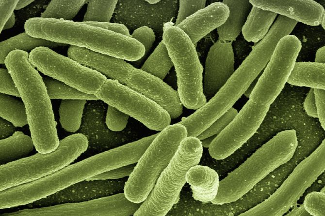 Escherichia E coli,  Ešerihija koli bakterija bakterije