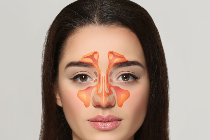 Nos, Njuh, Sinusi, glavobolja, upala sinusa, devojka, prehlada Nos, Njuh, Sinusi, glavobolja, upala sinusa, devojka, prehlada