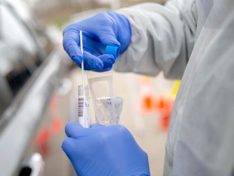 Test, testiranje, koronavirus Test, testiranje, koronavirus