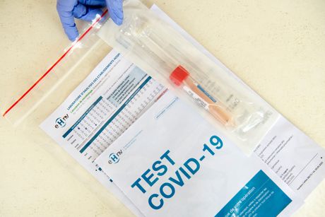 Test, testovi, koronavirus Test, testovi, koronavirus