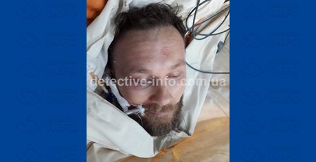 Tamara Zvicer (35), Radivoje Zvicer  (37)