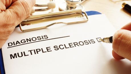 Multiple sclerosis, Multipla skleroza,  bolest, dijagnoza, dijagnostika