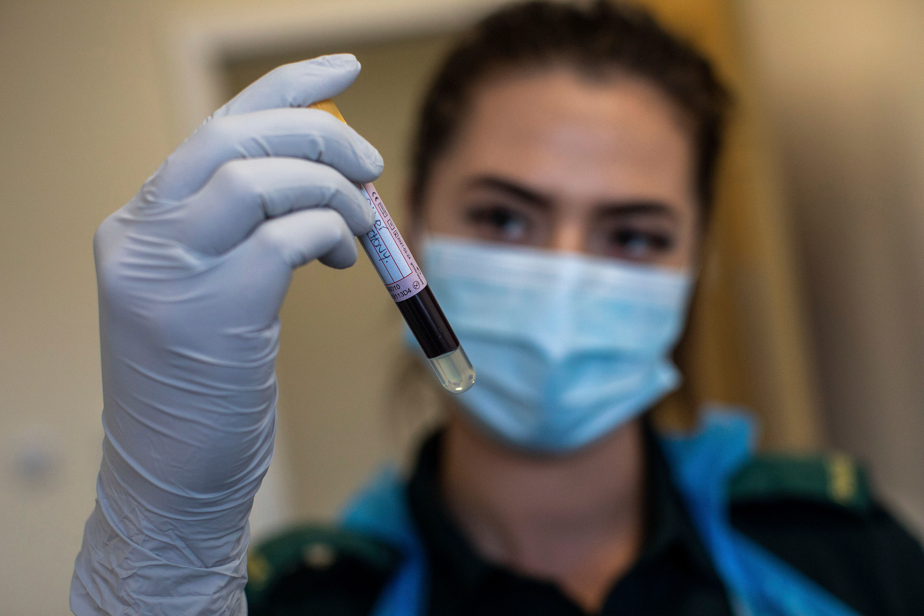 Pronađen biološki marker za depresiju? Jednostavan test krvi mogao bi da otkrije ovu bolest i pre simptoma