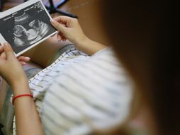 Abortus, spontani pobačaj, test na trudnoću, trudnica, maloletnička trudnoća, ginekolog, ginekološki pregled,ultrazvuk