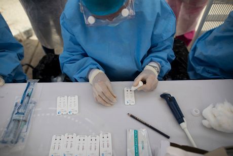Test, testovi, koronavirus Test, testovi, koronavirus