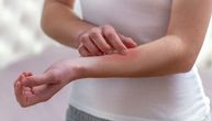 Žena (27) alergična na trčanje: Žurila na let i doživela anafilaktični napad