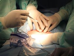 hirurgija, operacija, operaciona sala, bolnica, lekari, pacijent, bolest