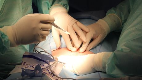 hirurgija, operacija, operaciona sala, bolnica, lekari, pacijent, bolest