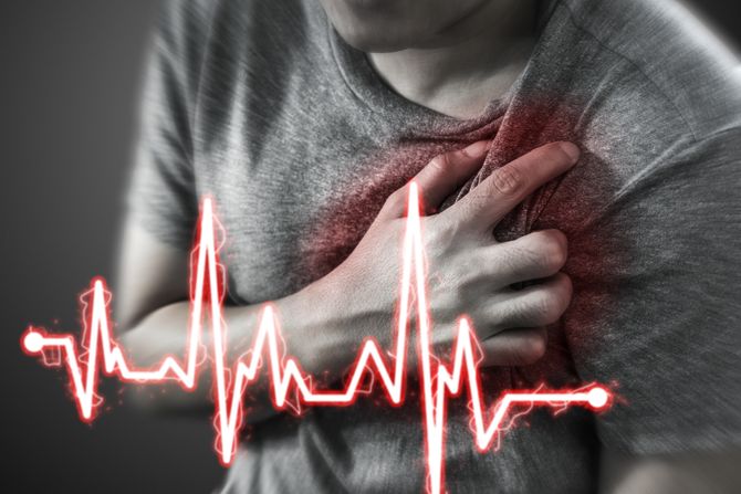 Srcani udar, infarkt. srce, pritisak, bol u grudima, ekg Srcani udar, infarkt. srce, pritisak, bol u grudima, ekg