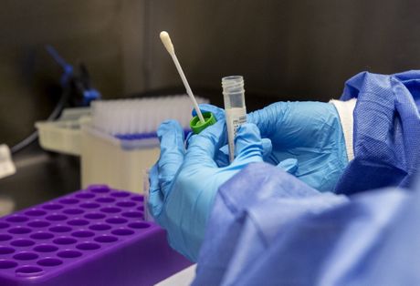Laboratorija test koronavirus ampule rukavice