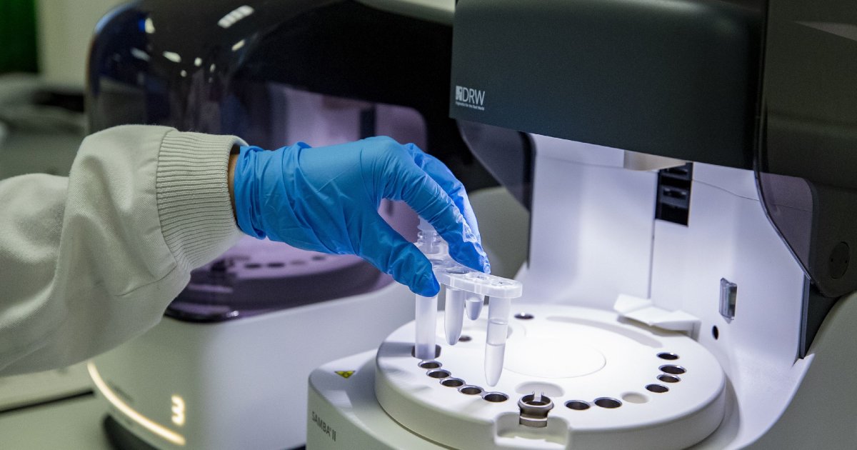 Šta pokazuje Ddimer i kako je povezan sa koronom Telegraf.rs