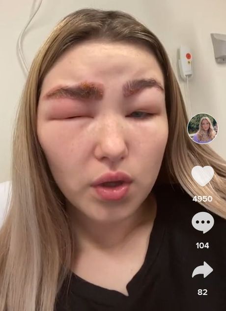 Mili Baknel Mili Baknel