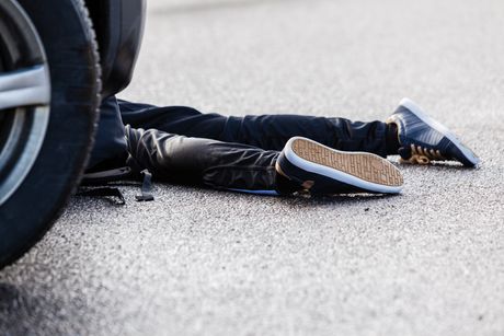 Dete ulica nesreća noge pregaženo auto