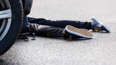 Dete ulica nesreća noge pregaženo auto