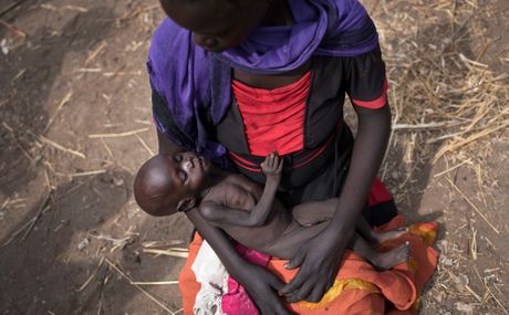 Južni Sudan deca glad gladovanje