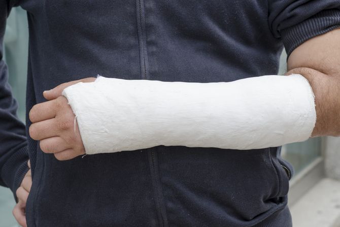 Polomljena ruka, zavoj, gips