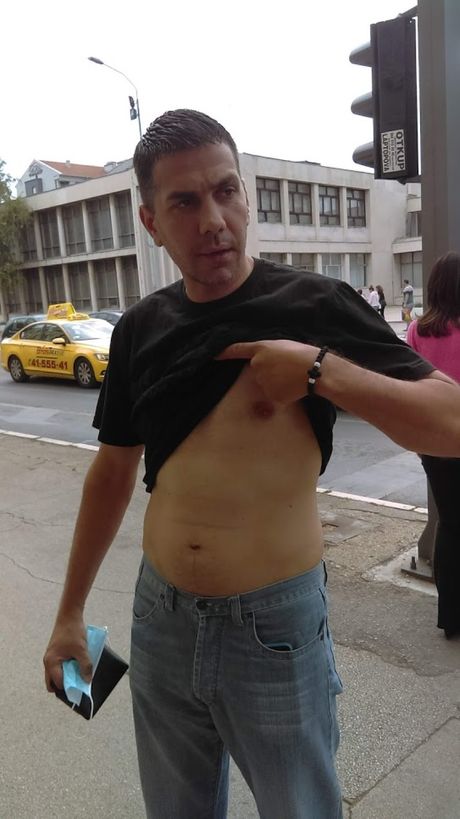 Nenad Mitrović, pokušaj ubistva, ubodna rana Nenad Mitrović, pokušaj ubistva, ubodna rana