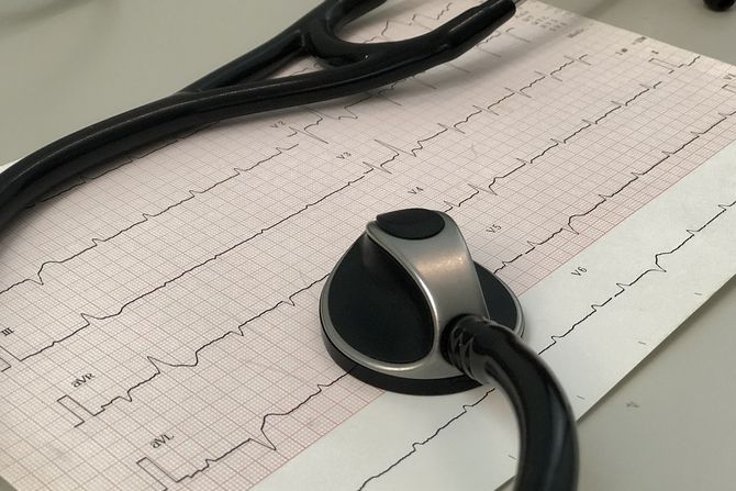 EKG, lekar, pregled, srce, doktor, lek, analize