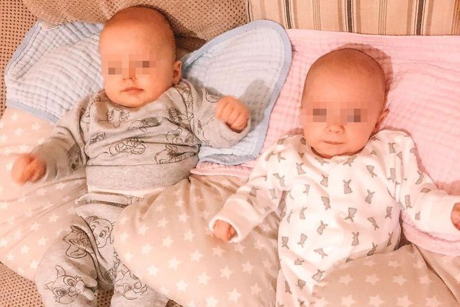 Noa i Rozali blizanci, od majke Rebeke, Rare Special Twins, Noah, Rosalie, Rebecca Roberts Noa i Rozali blizanci, od majke Rebeke, Rare Special Twins, Noah, Rosalie, Rebecca Roberts