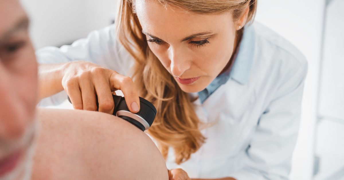 Russian scientists are developing the FIRST drug for melanoma: They plan to complete tests by 2027.