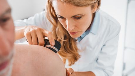 Melanom, mladež, pregled kože