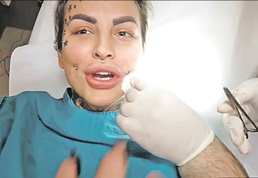 "Imam dijagnozu već šest godina" Bivša zadrugarka o zdravstvenom stanju: "Povremeno imam napade"