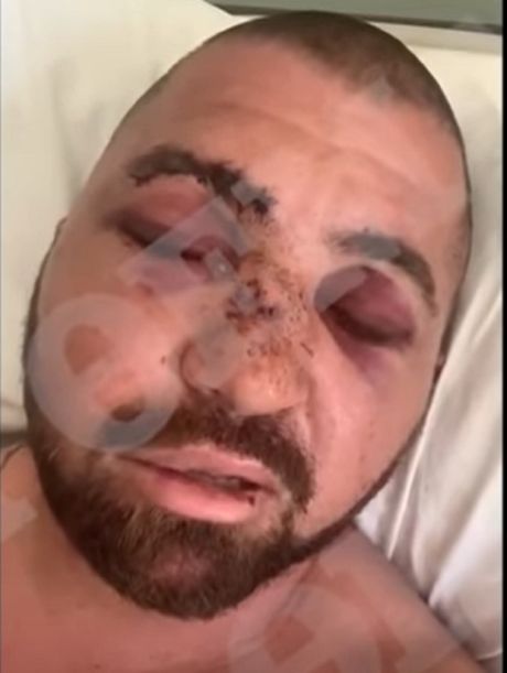 Telohranitelj Nikos, Dan Bilzerian