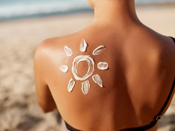 Opekotine, opekotine od sunca, sunčanje