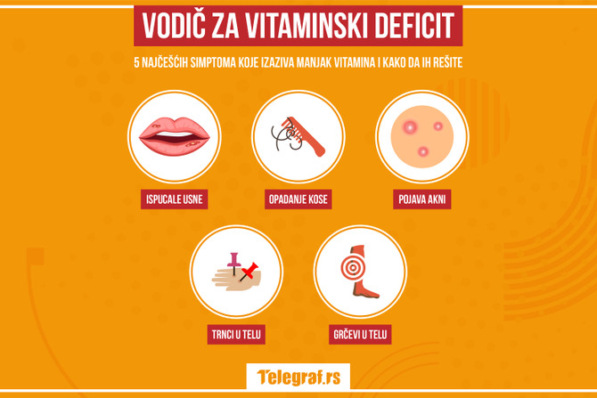 Vodič za vitaminski deficit: 5 najčešćih problema koje možete da rešite promenom ishrane - Vimarsana News