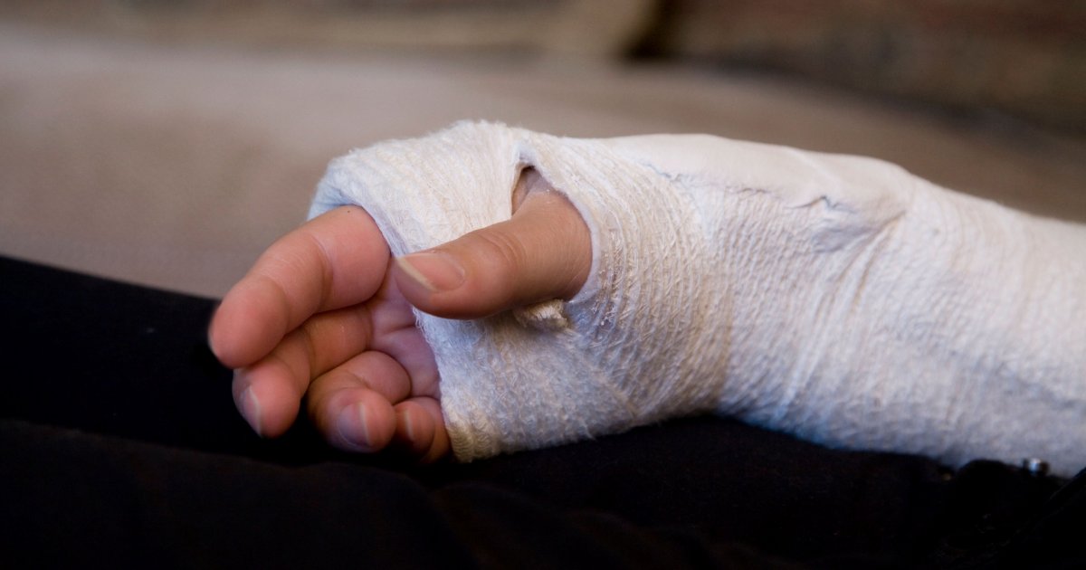 Gips Ruka Hit priča iz saobraćaja: Žena taman skinula gips sa jedne ruke, oborena ...