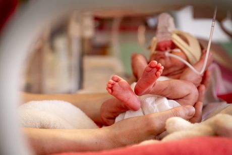 Dete beba prevremeno rođeno inkubator incubator