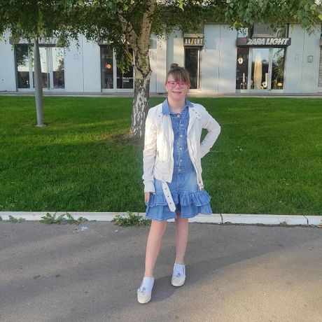 Devojčica sa Daunovim sindromom Teodora Devojčica sa Daunovim sindromom Teodora