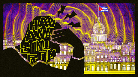 Havana Sindrom, Amerika Kuba, radio talasi, zrikavac