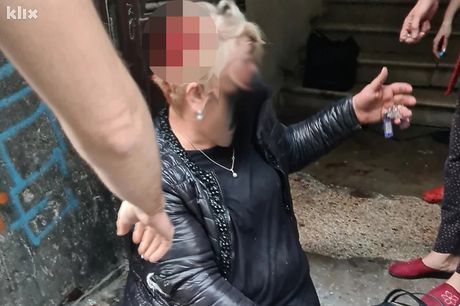 Dobermani izujedali ženu, Sarajevo Dobermani izujedali ženu, Sarajevo