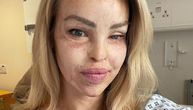 Tražili od AI-ja da joj "popravi lice", a poznata voditeljka poslala snažnu poruku