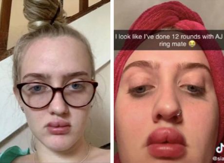 Sianna Cooney napumpana usta usne Sianna Cooney napumpana usta usne